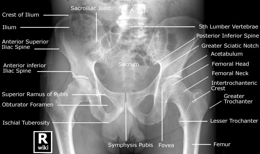 Pelvic Fractures — Kwak Talk